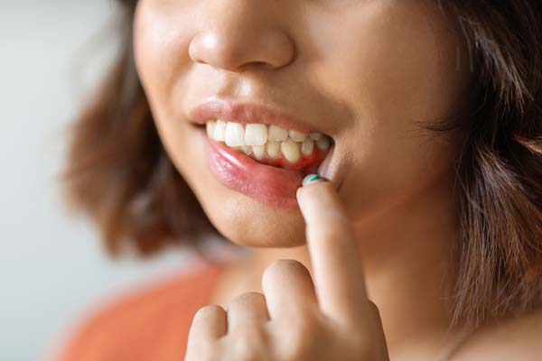 Can Gum Disease Be Cured?